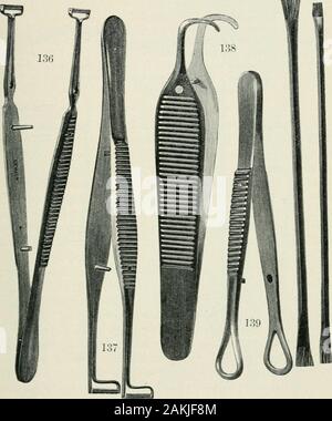 Atlas et incarnation de coopératives d'ophtalmologie . ceps ne s'impose pas. Le affectedportion du tissu est manipulé par le dessin avec l'instrument jusqu'à ce qu'il est libre de granules. Le anglesof le couvercle et, si nécessaire, la caroncule doit être carefullyattended à. Si la conjonctive tarsale,granules contient une lame du rouleau des forceps est appliquée à la peau de thelid et l'autre à la conjonctive, et le instrumentpassed sur le couvercle plusieurs fois de cette façon jusqu'à ce que tous les thegranules ont disparu. Dans toutes ces opérations d'exprimer c'est un sage, porter des precautionto Banque D'Images