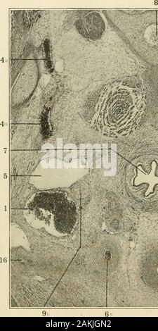 Le journal américain de l'anatomie comparée . Fig. Schéma 8 tirées d'une reconstruction des veines jugulaires, sacand lymphatique nerfs dans un embryon de 8 jours et 14 heures. Côté droit.1, Precardinal ; 4a, veine vertébrale ; 5, sac lymphatique jugulaire ; 5a, la notation en ovalshows la position du robinet de la sac lymphatique jugulaire (voir fig. 9 et 10) ; 9a,13 ; du plexus brachial, canal thoracique ; 14, 15 ; veine sousclavière, lymphaticduct sous-cutanée. 488 A. M. MILLER. Banque D'Images