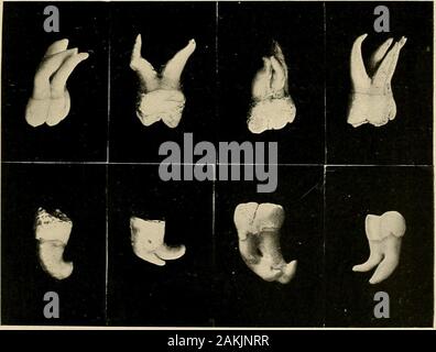 Principes et pratique de la dentisterie opératoire . Fig. 716.. Banque D'Images