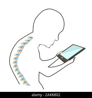 Le syndrome du cou du texte. La courbure de la colonne vertébrale, la lordose cyphose, du cou, scoliose, arthrose. Une mauvaise posture et de Stoop. Icône silhouette linéaire Illustration de Vecteur