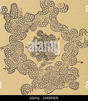 La consommation pulmonaire, pneumonie, et des maladies des poumons : l'étiologie, la pathologie et le traitement, avec un chapitre sur le diagnostic physique . gueur en grande partie sur la pressionexercée divers degrés de chacune. Dans la première, la pression s'installe rapidement et le sérum du sang est forcée à travers le wallsof soudainement le sang-navire dans les alvéoles, avec somewhite et sang rouge-globules, tandis que dans le deuxième cas, la pression est probablement moins intense et certainement plus gradualin la plupart des cas, et est diffusé sur une période plus longue, et le sang oftime-navires ont une meilleure occasion Banque D'Images