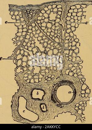 La consommation pulmonaire, pneumonie, et des maladies des poumons : l'étiologie, la pathologie et le traitement, avec un chapitre sur le diagnostic physique . Fig. II.-poumon gauche. Vue de côté. Fig. 12.-poumon droit. Vue de côté. pendages. Dans les murs de la trachée et des bronches tubesring les cartilages en forme de développer, qui maintiennent ces structuresdistended. Les poumons, comme tous les autres organes, de posséder un cadre tosupport constituant leurs structures. Il se compose d'thepleura, le et interlobulaires interlobaires et intra-alveolarsepta, et de ces sont suspendus les bronches, aircells, nerfs, vaisseaux sanguins Banque D'Images