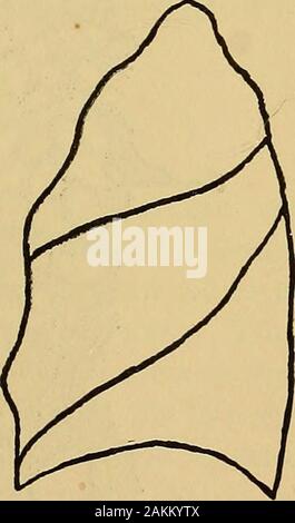 La consommation pulmonaire, pneumonie, et des maladies des poumons : l'étiologie, la pathologie et le traitement, avec un chapitre sur le diagnostic physique . Fig. II.-poumon gauche. Vue de côté. Fig. 12.-poumon droit. Vue de côté. pendages. Dans les murs de la trachée et des bronches tubesring les cartilages en forme de développer, qui maintiennent ces structuresdistended. Les poumons, comme tous les autres organes, de posséder un cadre tosupport constituant leurs structures. Il se compose d'thepleura, le et interlobulaires interlobaires et intra-alveolarsepta, et de ces sont suspendus les bronches, aircells, nerfs, vaisseaux sanguins Banque D'Images