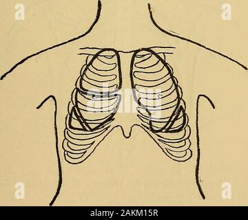 La consommation pulmonaire, pneumonie, et des maladies des poumons : l'étiologie, la pathologie et le traitement, avec un chapitre sur le diagnostic physique . avait été présente expérimentalement avec une seringue hypodermique. Pourquoi l'infection par doesthe ne parviennent pas à se propager et de faire tuberculosisas pulmonaire dans le cas d'animaux ? Est-ce parce que le sol est non-recep-ment ? C'est peut-être vrai, mais les personnes en bonne santé peuvent hardlybe a déclaré des cas de maladie, et de Potts tuberculose de l'theperitoneum. Est-ce parce qu'il y a une différence dans l'vitalresistance pour les bacilles entre l'homme et les animaux ? Ou est itprincipally beca Banque D'Images