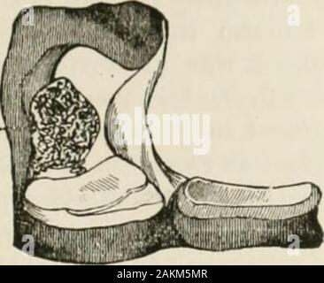 L'Encyclopédie internationale de chirurgie, un traité systématique sur la théorie et la pratique de la chirurgie . Banque D'Images