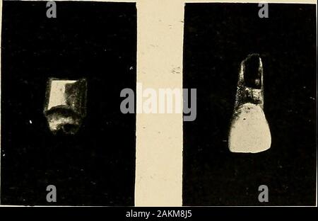 Principes et pratique de la dentisterie opératoire . Fig. 592.  ? Fig. 596. Fig. 593. Banque D'Images