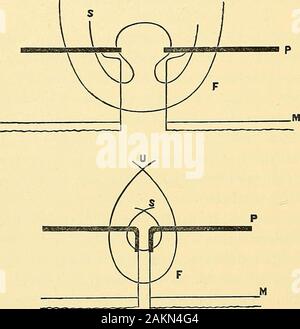 Chirurgie abdominale profonde devrait être sutures . placedabout trois quarts de pouce d'intervalle ; et ils devraient converger, becarried un peu, au-delà des extrémités de l'incision. Puis le superficiel sont placés, entre deux eachdeep suture. La première aiguille perfore le muscle du péritoine et sortir,un peu au-dessous de la lèvre de la blessure ; puis il ramasse upthe bord libre du péritoine de son côté, et finallypursues le même cours en sens inverse avec l'autre Kaisersclinitt* Dey, &c., Leipzig, 1882. 282 Césarienne. Côté. Le schéma, après Sanger, montre plus clairement cette thanany d Banque D'Images