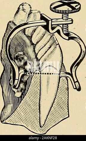 Principes et pratique de la dentisterie opératoire . Fig. 402. Banque D'Images