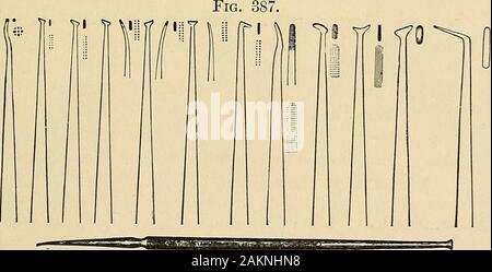 Principes et pratique de la dentisterie opératoire . Darby-Perry pluggers.. Chappell pluggers.Fig. 388. Banque D'Images