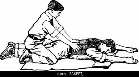 Accidents et urgences ; un manuel sur le traitement des urgences médicales et chirurgicales en l'absence d'un médecin . Fig. 4.-Expiration ; pression sur.. Fig. s.-l'inspiration ; pression. La combinaison doit entraîner environ 12 actes d'respirationin la minute. (.Voir Fig. 4 et 5.) L'OBSTRUCTION À RESPIR/VTION 9 tout en faisant ceci, l'assistant devrait réglementer son propre souffle-ing-respiration comme il pivote vers l'avant et en tant qu'il swingsbackward. Cette précaution permet à une personne d'ordinarystrength pour maintenir la respiration artificielle pendant une heure ou morewithout breathmg son propre désordre ou obtenir Banque D'Images