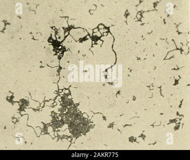 Principes et pratique de la dentisterie opératoire . .••^ / Fig. 241.-Streptococcus pyogenes. X 1000. - %. Banque D'Images