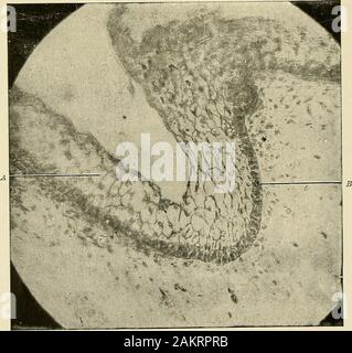 Principes et pratique de la dentisterie opératoire . ^&Lt ;- :, FlG. 20o-glandes de serres. X 50.. Fig. 204.-couche épithéliale de la muqueuse dans sa phase embryonnaire. A. Les cellules épithéliales squameuses ; £, les cellules cylindriques-rete Mali&gt;ighii. L'histologie des tissus dentaires. 67 Ces organismes sont trouvés en plus grand nombre autour du cou des theteeth à la marge de la gencive, et d'apparaître comme un pas creamymaterial jaunâtre contrairement à pus dans son aspect général. Thesecorpuscles Koelliker considéré comme une forme modifiée de pus, mais dans la mesure où ce matériel canalways dans cet endroit, même en bonne santé pe Banque D'Images