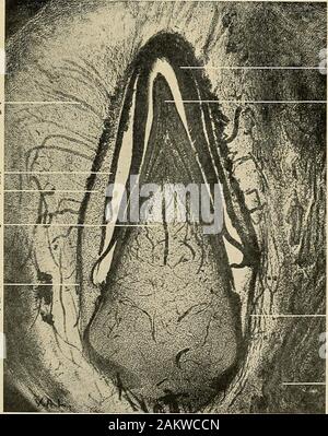 Principes et pratique de la dentisterie opératoire . Extérieur Intérieur ameloblasticmembrane stellaires endoplasmique ameloblasticmembrane intermediumCalcifying la dentine émail strate Fig. 144.-l'élaboration d'embrj dent-o'agneau. (D'après Andrews.) X 105. Capillaryblood vesseK FormiuL-émail, ename-orgai sang pulpe dentaire-yessel, découlant de la base de la papille dentaire. Formedenamel Formeddentin yessel-dentalpapilla,résultant d'Os frombase Fig. 145.-Vertcal section de l'incisive centrale du foetus humain (injecté), montrant l'offre le sang d'émail-organes. (V. A. Latham.) layei papillaire améloblastes sous forme Banque D'Images