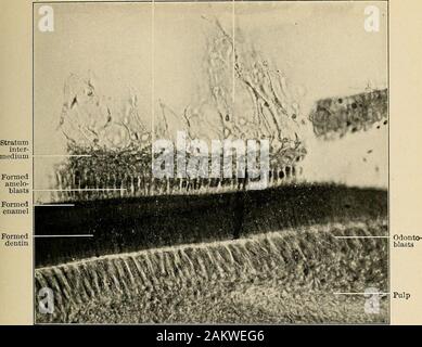 Principes et pratique de la dentisterie opératoire . Fig. 139.-l'élaboration d'émail, montrant les processus Tomess à ^4. (R. R. Andrews.) Former améloblastes. reticiilunn stellaire Formeddentin Fig. 140.-régionaldestiné Article de] :)age- human molar, montrant les relations entre les différentes structures. (V. A. Latham.) X 1000. Stratumintermedium Odontoblasts dentine formée Améloblastes Banque D'Images