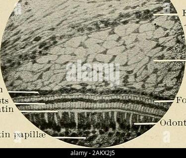 Principes et pratique de la dentisterie opératoire . Fig. 114.-Les droits de l'embrj-o à onze à douze semaines après la conception. • V ? ^ ? ? ?/ ?  ? ?. Stellatereticulum ? .  ? &Gt ; ^ . Amelo-blasts • • - ? Calco-spherites - Dentinpapillae^^-s^^ ^ ^^^,r.-- ? Capillaryblood •navire-a- 4 un ?:Un stratuminterme-dium premier licenciement-ers ofodonto Capillaryblood-blasts navire-Fig. 115.-section verticale de la molaire inférieure à la jonction d'eiiamel-ou.tran avec papille, sh(iwiii ofcell4 stade précoce de la différenciation et la zone de matériel amorphe. (V. A. Latham.) ;"-r^*y. -^ externe du tissu conjonctif embryonnaire de l'épithélium de l'ENAM Banque D'Images