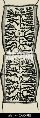 Les maladies du porc, avec référence à particulier hog-choléra . Fig. 95.-Les Œufs de Taenia solium.. Fig. 97.-segments matures d'Taeniasoliimi. Banque D'Images