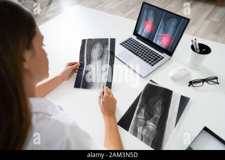 Genou Female Doctor Examining X-Ray On Laptop In Clinic Banque D'Images