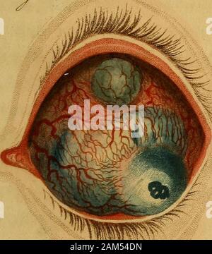 Un synopsis des maladies de l'œil, et leur traitement : à qui sont préfixés, une courte description anatomique et un croquis de la physiologie de cet organe . J^ S. Banque D'Images