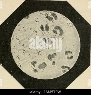 Traité pratique de bactériologie . de Diplobacillede la conjonctivite (fig. 90). Axenfeld (6) presque en mêmetemps arrivait à la même conclusion. (1) Grûnwald et Waldman.n, Studien ûber den bakteriellen Anteil an der Produk-liou der Ozoena Centralbl {Syndromes de fourrure. Bakt., 1 Abth., Orig., LX, 1911,p. 337). (2) semaines, Der akuten Bacilius des Bindehaiitcatarrhs {Arch. fur Augenheilk.,XVII, 1887, p. 318). (3) Kartulis, Zur Etiologie der agyptischen catarrhalischen tralbl Conjonctivite (Cen-fourrure Bakt.., I, p. 289). (4) M. Morax, Ileclierches rétiologie bactériologiques sur des conjonctivites aiguës.Th Banque D'Images
