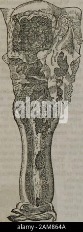 Porneiopathology : un traité sur les maladies vénériennes et d'autres maladies du système génital masculin et féminin : avec des remarques sur l'impuissance, l'onanisme, stérilité, pieux, et le gravier, et les ordonnances de leur traitement . Sur les maladies vénériennes. 93. Banque D'Images