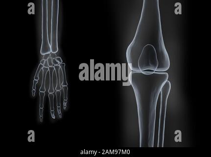 rendu en relief des os humains des mains et des genoux, film radiographique sur fond noir Banque D'Images