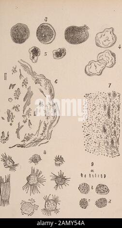 Revue médicale de Chicago et examinateur . ents diverses formes de groupes de cristaux d'acide satty, rencontrés dans la section prise d'une portion indurated du poumon tuberculeux bor-dering d'une caverne. Fig. 7 représente une petite partie d'une section d'une glande lymphatique bronchique, mentionnée dans le texte, Le parenchyme glandulaire a été déstroyé par l'action de la solution de potasse, exposant les cristaux à fullview. Fig. 8 représente les cristaux d'acides gras provenant de patchs et de globulesof de graisse dans la sputa tuberculeuse, traitée avec une solution de potasse caustique. Fig. 9. Pseudo-bacilles lepras; a, différent Banque D'Images