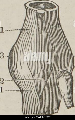 Le guide du dissecteur, ou, compagnon de l'étudiant : illustré par de nombreuses bosses, montrant clairement et expliquant la dissection de chaque partie du corps humain . ise la tête du fémur sur le bord de l'acétabulum, et il est ainsi accompli. 4. Méthode quand sur le pubis. — Le bassin étant fixé, l'extensionpeut être fait vers le haut et vers l'arrière, une serviette ayant été prémontée sous la cuisse blessée, afin de permettre à un assistant de lever la cuisse pendant l'extension, ce qui attirera la tête du fémur sur le bord de l'acétabulum. L'extension est alors à Banque D'Images