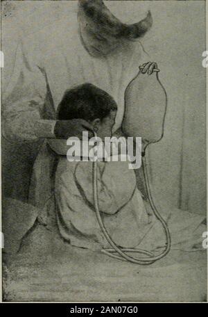 Maladies des enfants, pour les infirmières, y compris l'alimentation des nourrissons, les mesures thérapeutiques employées dans l'enfance, le traitement des urgences, la prophylaxie, l'hygiène et les soins infirmiers . Fig. 118.— méthode de syringing oculaire. Le coton tenu contre le nez devrait prévenir toute infection de l'autre oeil. Que le dropper de verre ordinaire, comme les enfants sont la lutte de proneto. EAR Syringing.—An EAR s)n:inge est rempli d'eau à l'intensité de iio° F. La buse en caoutchouc doux est placéduci le canal auditif externe et l'ampoule glysqueezed. Un demi-pinte à un quart d'eau est utilisé. Une seringue de fontaine maintenue sur un niveau Banque D'Images