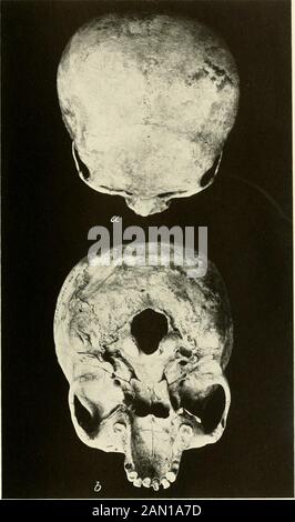 Collections diverses Smithsonian . Crâne de squelette déformé artificiellement illustré dans la plaque 1Figure 1. Vues de face et De Côté SMITHSONIAN DIVERS COLLECTIONS vol. 94, N° 14, PL. 3. Vues du haut et Du Bas du crâne Déformé Présentées dans les COLLECTIONS DIVERSES SMITHSONIAN plate 2 vol. 94, N° 14, PL. Banque D'Images