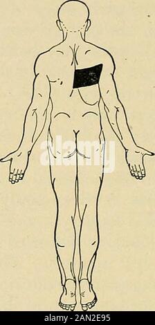 Maladies nerveuses organiques et fonctionnelles; un livre de texte de neurologie . Banque D'Images