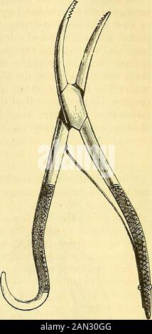 Un système de chirurgie : pathologique, diagnostique, thérapeutique et opératoire . Fie. 812 Banque D'Images