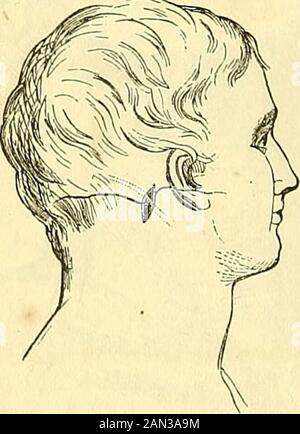 Un système de chirurgie : pathologique, diagnostique, thérapeutique et opératoire . Ligature de l'artère faciale. Fig. 276. Fis. 277. Banque D'Images