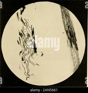 La teigne à la lumière de recherches récentes : analyses, le traitement, la prophylaxie . Fi-. ir.. Fig. 19. -Cheveux de soalp : section transversale, montrant l'extérieur aussi insideliair champignon anil. Fig. 2i&gt ;.-même cheveux : section transversale, montrant l'intérieur du champignon d'un sèche seulement. Banque D'Images