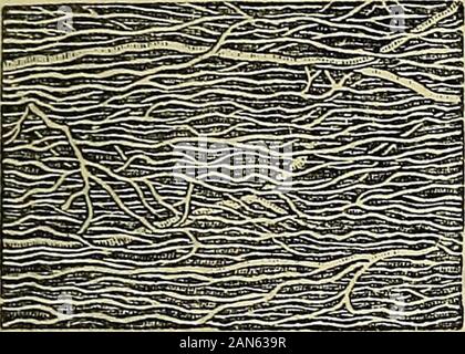 Principes du charpentier de la physiologie humaine . Distribution des capillaires de surfacela portée sur la peau du doigt. Fig.158. La distribution d'aroundfollicles les capillaires de la muqueuse. Fig. 159.. Banque D'Images