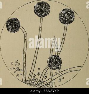 Un traité pratique sur les maladies rénales et urinaires : y compris les dépôts urinaires . orules et filetage du thalle. de la levure (champignon qui pousse luxueusement dans urineexposed diabétiques à l'air à température modérée), au lieu d'un tuftof branches a une tête sphérique. Lorsque la plante a attainedits fructification complète, le thalle de lit flottant apparaît avec un dustedover poudre marron. Sous le microscope, le brownmatter est constitué de la tête sphérique plein de sporules.Ces, une fois mûrs, burst et s'acquitter de leurs sporules, whichsink au fond du verre et forme un livre blanc Banque D'Images