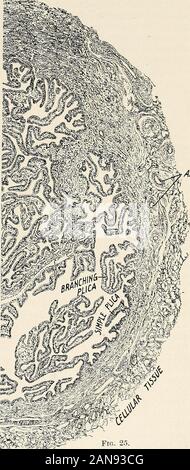 Pour les étudiants et les praticiens gynécologie . generaltubal dentical avec la muqueuse. Le tube est sup-retordus avec sang dans thegreater partie de son ex-tente de le tubalbranches ovarianartery du innermostpart ; l'isthme de l'issupplied astomotic à partir de l'an-dela direction générale de l'artère utérine {seeFig. 44). Le lym-phatics pass en société avec ceux du corps de l'utérus pour theiliac les glandes. La continuité du theuterine belowand avec lumen empreinte le peritonealcavity rendersthe au-dessus du tube, susceptible d'en-fection des deux direc-tions. Dans l'ordre croissant-fection est vu dans gonor-rhoea et sepsis, themorb Banque D'Images