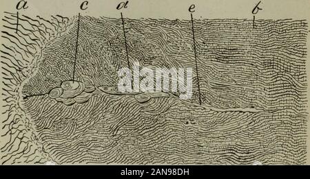 Le cosmos dentaire . a probablement une matrice de colle-matériau donnant similaire à anddentine cément. Je n'ai jamais été en mesure de faire des lacunes de manière satisfaisante. 9° LA DENTAL COSMOS. Des lignes sombres qui semblent marquer le collage imparfait de l'accouplement. Therods eux-mêmes sont granulaires et imparfaitement formée. Cette linehas mais peu de force physique. Dans la Fig. 13 Je vous présente une autre forme de fusion imparfaite des plaques d'émail. Dans ce cas, une première dent, un jeune bicuspidie bien développés,avec de longues cuspides, supprimés pour faire de la place dans un cas d'irrégularité, wasso coupé comme d'obtenir une section parallèle à l'Ename Banque D'Images