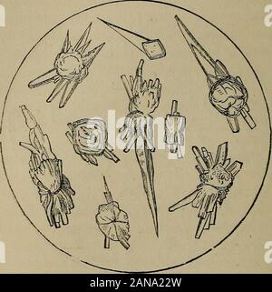 Un traité pratique sur les maladies rénales et urinaires : y compris les dépôts urinaires . Fig 5. Stars de l'acide urique. 62 dépôts inorganiques. variété sans fin de ces étoiles sont merveilleux, et rendre themseductive objets microscopiques (Figs. 5 et 6).. Fig. 0. Stars et les pointes de l'acide urique. Parfois, les rayons s'étendent seulement dans une direction, et d'un ventilateur en forme de figure est produit, ou deux ventilateurs sont réunies dans une même commoncenter (Fig. 6). Banque D'Images