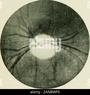 Un essai sur l'histoire de l'électrothérapie et de diagnostic ; . Banque D'Images