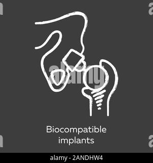 Les implants biocompatibles icône Chalk. Compatible avec les tissus vivants. Articulation artificielle. Appareil prothétique. Remplacer la structure biologique. Bioengin Illustration de Vecteur