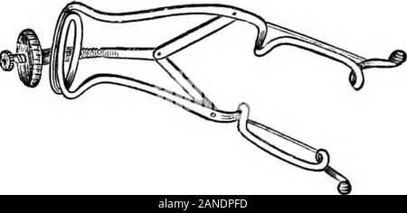 Un dictionaryBeing médical illustré ! un dictionnaire des termes techniques utilisés par les auteurs sur la médecine et les sciences de la garantie, dans le latin, anglais, français et en allemand . NOTESS SPÉCULUM OEIL améliorée. Banque D'Images
