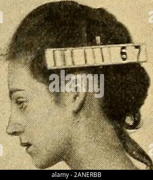 Courbure latérale de la colonne vertébrale et des épaules . Banque D'Images