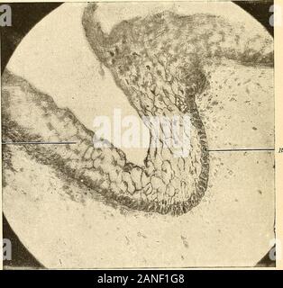 Principes et pratique de la dentisterie opératoire . terres de serres. X 50.. Fig. 204.-couche épithéliale de la muqueuse dans sa phase embryonnaire. Un cellsB épithéliales squameuses, colonnaires, rete-Malpighii. Chapitre IV. Éruption DES DENTS. Définition.-Le processus par lequel les dents à l'avance de l'bonycrypts, dans laquelle ils ont subi la calcification de leur crownsand une partie de leurs racines, et sont forcés par les gencives. Synonymes.-ses dents ; tailler des dents ; la dentition. La dentition est un processus physiologique n'ayant pas d'équivalent dans le growthof d'autres tissus. Fig. 205 représente une de Banque D'Images