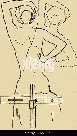 Courbure latérale de la colonne vertébrale et des épaules . Banque D'Images