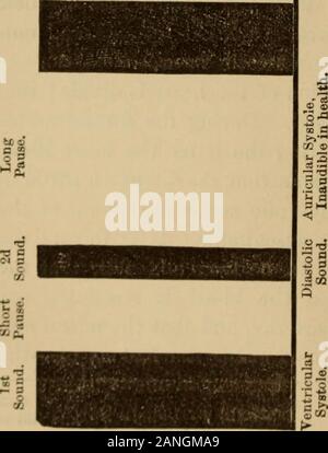 Les maladies du coeur et la circulation dans l'enfance et l'adolescence, son complexe .-le-niiis culo-themuscular valvulaire ; son beingmade par thestroke élément apparent du cœur againstthe-poitrine et mur par theaudible thecardiac la contraction de muscle. Il est thelong, faible, terne boom. Thesecond, ou valvulaire, soundis courte, clac-clac, brusque,et de sonnerie ; c'est almostpurely isdue valvulaire, et la mort soudaine de l'closureof,valves semi-lunaires aortiques et pulmonaires La.Bien qu'il s'happeningthe est sang-ing trouver lentement son chemin d'auriclesto theopened ventricules à travers et mitrale tricus-pid vannes dans ou Banque D'Images