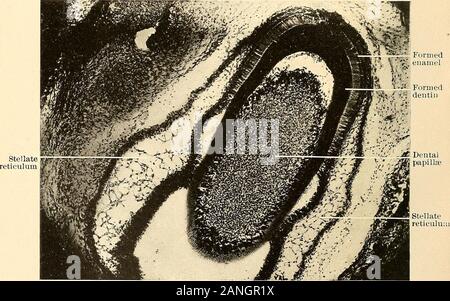 Principes et pratique de la dentisterie opératoire . . : Dentinpapillae Capillaryblood-navire ** ? ?  ? ? V - ?  ? ? • ?... K ? J'Stratuminterme-dium premier licenciement-ers- ofodonto . Capillaryjlood- Fig. 115.-section verticale de l'émail à la jonction du molaire-orgue avec la dentine ? papille, montrant début ofcell la différenciation et zone de matériel amorphe. (V. A. Latham.) X 300. TissuejS conjonctif embryonnaire9 ?s l'épithélium externe de l'émail-organes endoplasmique stellaire AmeloblastomaCalcined Stratum intermedium cabosser-" papille dentine* !Fig. 116.-section verticale de *ws, formant des ameloblastsOdontoblasts Banque D'Images