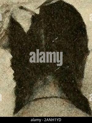 Courbure latérale de la colonne vertébrale et des épaules . Banque D'Images