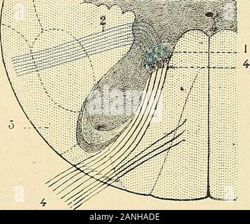 Traité d'anatomie humaine . res, nous le savons (voy. p. 433), se rendent, après entre-croisement, au cordon antéi-ieur ou au cordon latéral. Outre les 60 pi-écitées, à direction transversale et croisées, la commissural blanclie anté-i-icurc nous présente des libres à direction longitudinale. Les fibres longitudinales de la SCÉ forment, chezles animaux (345), deux faisceaux conq:iactes et nettement à droite de l'occupant, distincts et àgauclie la partie postéro-internc commissure de la blanche. Rhdmiue Clicz, nous ne trouvonsplus, aux lieu et place de ces deux faisceaux, que de tout petits lascicules Banque D'Images