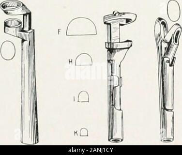 Peroral endoscopie et chirurgie laryngée . Fig. 126.. Banque D'Images