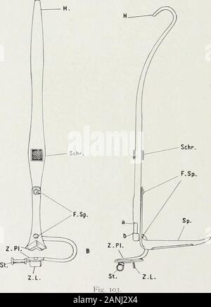 Peroral endoscopie et chirurgie laryngée . Fig. Mauvais à 116. 140 SUSPENSION LARYNGOSCOPIE. De la fin d'une série de détails ont été ajoutés. La langue-spatule doit être asimple instrument qui a une poignée pour attachmentto particulièrement formé la suspension-crochet, (m) Fig. 107 ; la surface supérieure qui est di-corrigées vers la langue est rugueuse (Fig. 107n), de façon à ce que la spatule willnot de glisser. Son extrémité antérieure est en forme de coeur après le modèle d'theReichert crochet pour soulever l'épiglotte (Fig. llJ). Sur la libre sur-visage de la langue-spatule on observe une gouttière (o). Dans ce caniveau. est placé une deuxième petite Banque D'Images